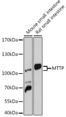 Western Blot: MTTP AntibodyBSA Free [NBP3-04433]